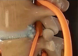 354c997155663114bf23bbebc4131a2e.gif